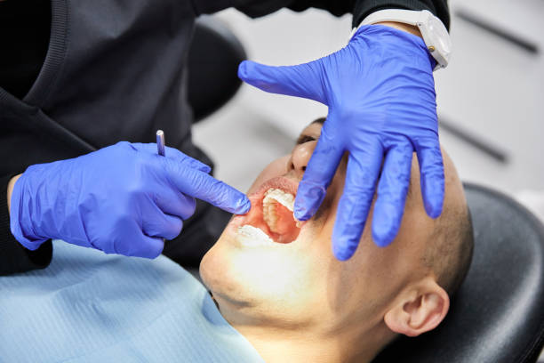 Best Urgent Care for Lost Fillings or Crowns in Belmond, IA